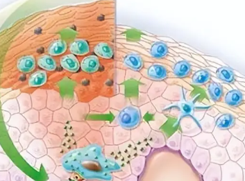 男性生殖器疱疹是怎么回事？可以进行中医药医治？