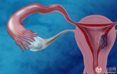 试管婴儿技术发展到哪一步了在做试管婴儿前调理身体