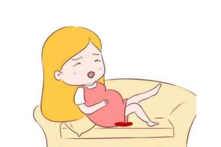 孕妇流产后可以吃什么水果 孕妇流产后可以吃羊肉吗 孕妇流产后可以吃什么水果 孕妇流产后可以吃羊肉吗