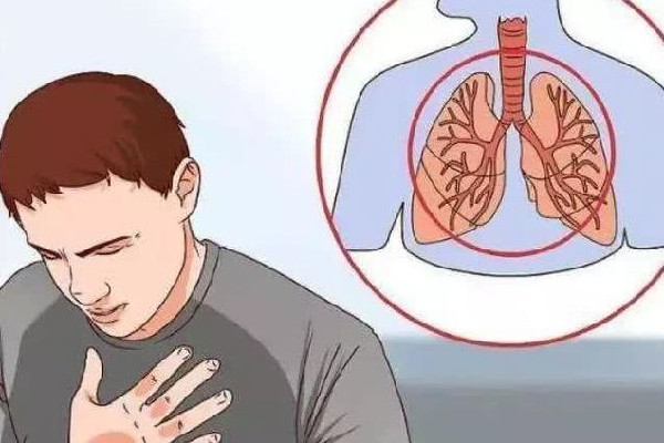 咳嗽什么样子代表要好了 咳嗽快速止咳小妙招