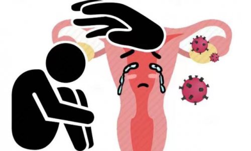 双腿出现哪些迹象是宫颈癌的表现