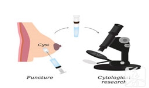 乳腺癌忌口食物有哪些