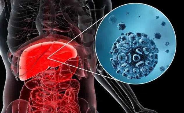 酒精肝和乙肝哪个严重 ？怎么治疗酒精肝?？