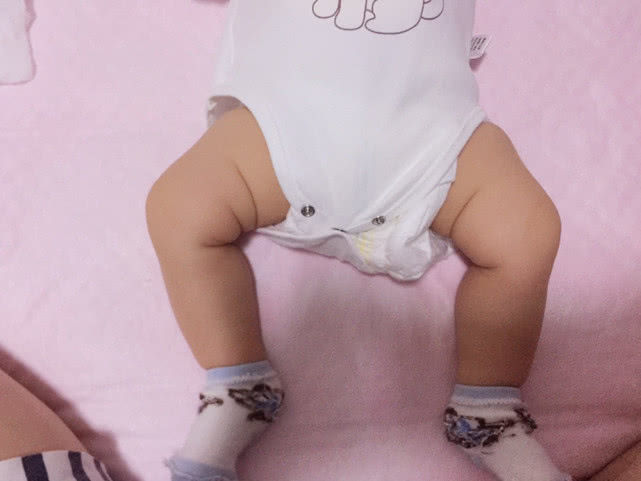 腿部也能看出健康问题宝宝双腿出现这3种情况 妈妈就该注意了