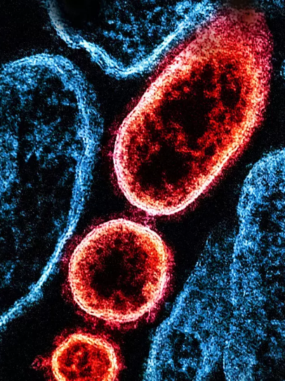 尼帕病毒是什么？来自果蝠的致命馈赠